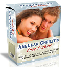 Angular Cheilitis Free Forever PDF